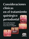 CONSIDERACIONES CLINICAS EN EL TRATAMIENTO QUIRURGICO PERIODONTAL