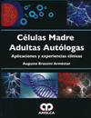 CELULAS MADRE ADULTAS AUTOLOGAS