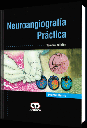 NEUROANGIOGRAFIA PRACTICA. 3� EDICI�N