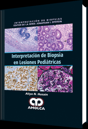 INTERPRETACION DE BIOPSIA EN LESIONES PEDIATRICAS (INTERPRETACION DE BIOPSIAS)