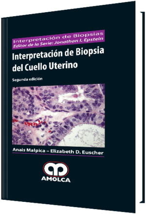 INTERPRETACION DE BIOPSIA DEL CUELLO UTERINO (INTERPRETACION DE BIOPSIAS). 2 EDICIN