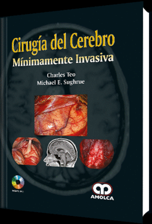 CIRUGIA DEL CEREBRO MINIMAMENTE INVASIVA + DVD