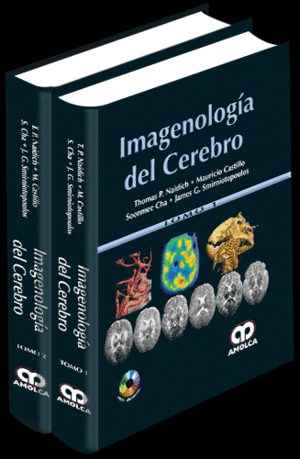 IMAGENOLOGIA DEL CEREBRO, 2 VOLS. + DVD