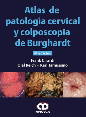 ATLAS DE PATOLOGIA CERVICAL Y COLPOSCOPIA DE BURGHARDT. 4 EDICIN