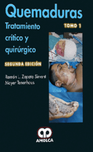 QUEMADURAS. TRATAMIENTO CRITICO Y QUIRURGICO, 2 VOLS. 2� EDICI�N