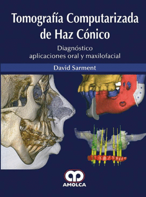 TOMOGRAFIA COMPUTARIZADA DE HAZ CONICO. DIAGNOSTICO APLICACIONES ORAL Y MAXILOFACIAL