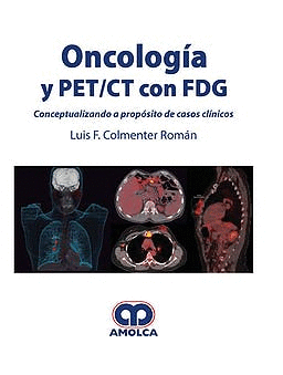 ONCOLOGA Y PET/CT CON FDG. CONCEPTUALIZANDO A PROPSITO DE CASOS CLNICOS
