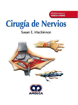 CIRUG�A DE NERVIOS + VIDEOS ONLINE