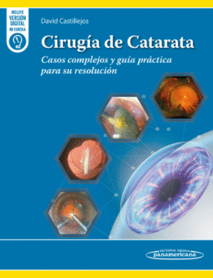 CIRUG�A DE CATARATA. CASOS COMPLEJOS Y GU�A PR�CTICA PARA SU RESOLUCI�N