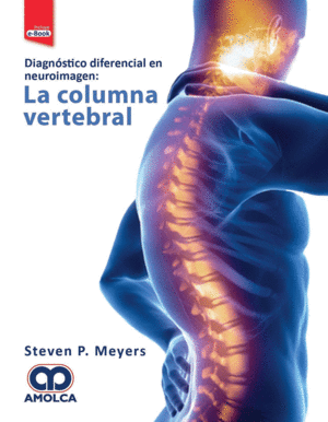 DIAGNÓSTICO DIFERENCIAL EN NEUROIMAGEN: LA COLUMNA VERTEBRAL + E-BOOK