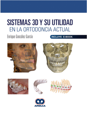 SISTEMAS 3D Y SU UTILIDAD EN LA ORTODONCIA ACTUAL (INCLUYE E-BOOK)
