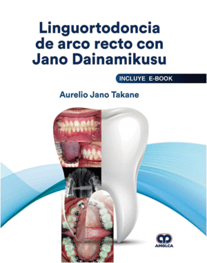 LINGUORTODONCIA DE ARCO RECTO CON JANO DAINAMIKUSU (INCLUYE E-BOOK)