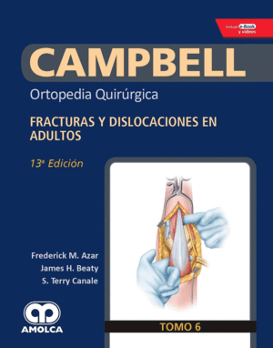 CAMPBELL ORTOPEDIA QUIRÚRGICA, TOMO 6: FRACTURAS Y DISLOCACIONES EN ADULTOS + E-BOOK Y VIDEOS. 13ª E