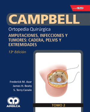 CAMPBELL ORTOPEDIA QUIRÚRGICA, TOMO 2: AMPUTACIONES, INFECCIONES Y TUMORES: CADERA, PELVIS Y EXTREMI