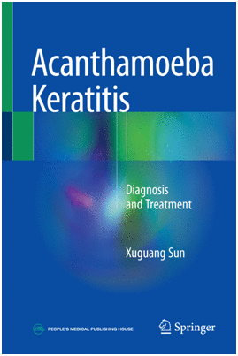 ACANTHAMOEBA KERATITIS. DIAGNOSIS AND TREATMENT