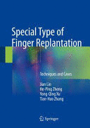 SPECIAL TYPE OF FINGER REPLANTATION. TECHNIQUES AND CASES