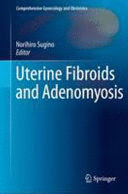 UTERINE FIBROIDS AND ADENOMYOSIS (COMPREHENSIVE GYNECOLOGY AND OBSTETRICS)