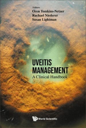 UVEITIS MANAGEMENT. A CLINICAL HANDBOOK