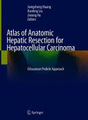 ATLAS OF ANATOMIC HEPATIC RESECTION FOR HEPATOCELLULAR CARCINOMA. GLISSONEAN PEDICLE APPROACH