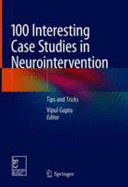 100 INTERESTING CASE STUDIES IN NEUROINTERVENTION. TIPS AND TRICKS