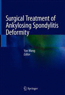 SURGICAL TREATMENT OF ANKYLOSING SPONDYLITIS DEFORMITY
