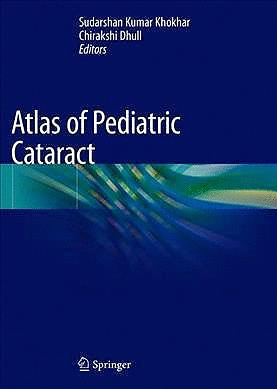 ATLAS OF PEDIATRIC CATARACT