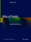 ATLAS OF UVEITIS. DIAGNOSIS AND TREATMENT. DIAGNOSIS AND TREATMENT