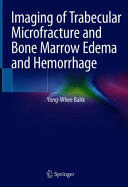 IMAGING OF TRABECULAR MICROFRACTURE AND BONE MARROW EDEMA AND HEMORRHAGE