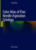 COLOR ATLAS OF FINE NEEDLE ASPIRATION CYTOLOGY