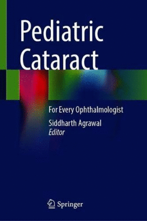 PEDIATRIC CATARACT. FOR EVERY OPHTHALMOLOGIST