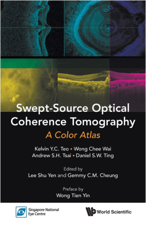 SWEPT-SOURCE OPTICAL COHERENCE TOMOGRAPHY. A COLOR ATLAS