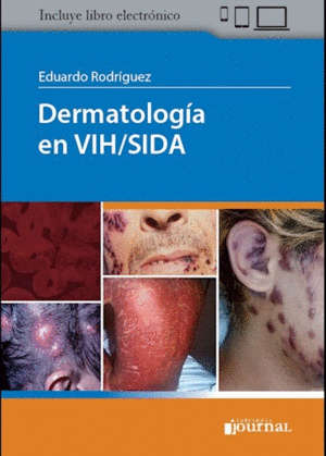 DERMATOLOGÍA EN VIH/SIDA (INCLUYE E-BOOK)