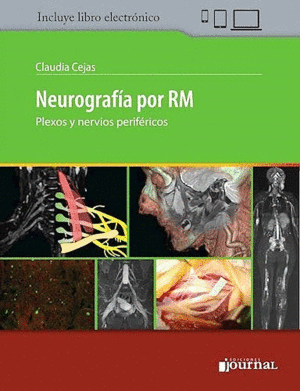 NEUROGRAFÍA POR RM. PLEXOS Y NERVIOS PERIFÉRICOS + E-BOOK