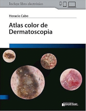 ATLAS COLOR DE DERMATOSCOPIA + E-BOOK