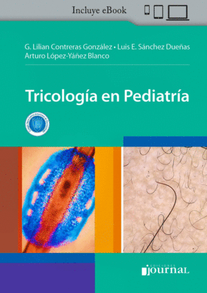 TRICOLOGA EN PEDIATRA