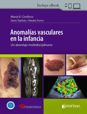 ANOMALAS VASCULARES EN LA INFANCIA. UN ABORDAJE MULTIDISCIPLINARIO