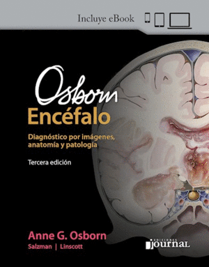 OSBORN ENCFALO. DIAGNSTICO POR IMGENES, ANATOMA Y PATOLOGA