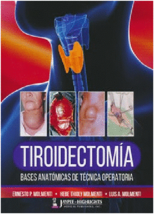 TIROIDECTOMA. BASES ANATMICAS DE TCNICA OPERATORIA
