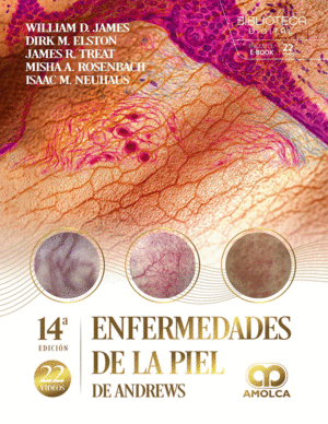 ENFERMEDADES DE LA PIEL DE ANDREWS