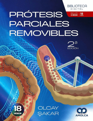 PR�TESIS PARCIALES REMOVIBLES
