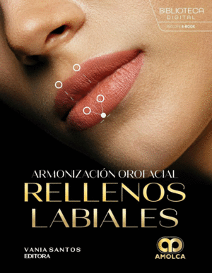 ARMONIZACI�N OROFACIAL. RELLENOS LABIALES