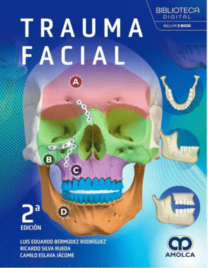 TRAUMA FACIAL