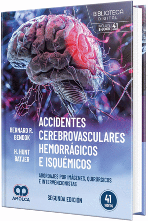 ACCIDENTES CEREBROVASCULARES HEMORR�GICOS E ISQU�MICOS. ABORDAJES POR IM�GENES, QUIR�RGICOS E INTERVENCIONISTAS