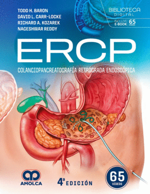 ERCP. COLANGIOPANCREATOGRAF�A RETR�GRADA ENDOSC�PICA