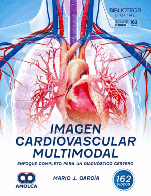 IMAGEN CARDIOVASCULAR MULTIMODAL. ENFOQUE COMPLETO PARA UN DIAGN�STICO CERTERO