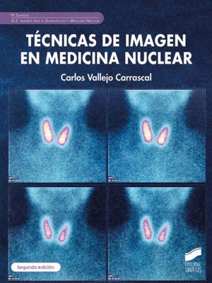 T�CNICAS DE IMAGEN EN MEDICINA NUCLEAR