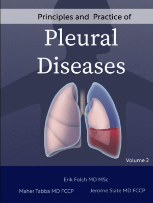 PRINCIPLES AND PRACTICE OF PLEURAL DISEASES: VOLUME 2
