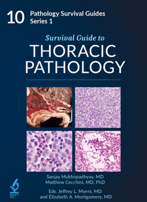 SURVIVAL GUIDE TO THORACIC PATHOLOGY (PATHOLOGY SURVIVAL GUIDES SERIES 1, VOL. 12)