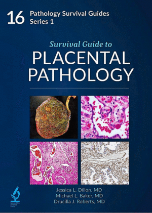 SURVIVAL GUIDE TO PLACENTAL PATHOLOGY (PATHOLOGY SURVIVAL GUIDES SERIES 1, VOL. 16)